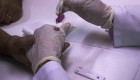 Mato Grosso do Sul registra um novo caso de Aids por dia