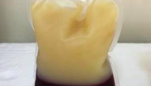 Hemosul descarta 15% das bolsas doadas