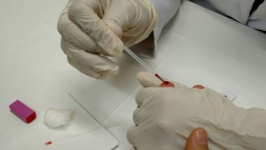 Metade dos jovens em Mato Grosso do Sul deve ser vacinada contra o HPV