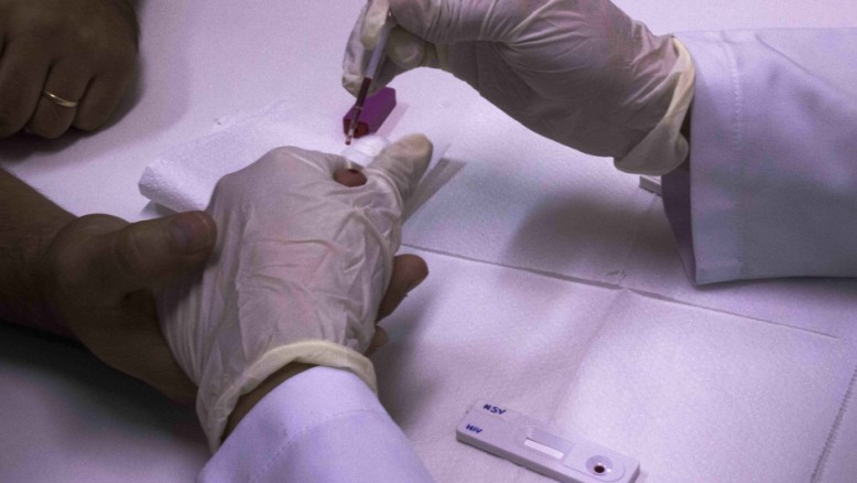 O tratamento para HIV/Aids, no Brasil, é universal e gratuito